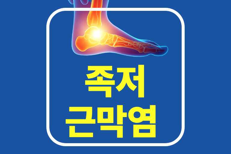 족저근막염 운동 2가지 방법(치료방법, 증상, 원인,지압법)